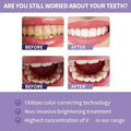 Toothpaste for Teeth Whitening (30ml)